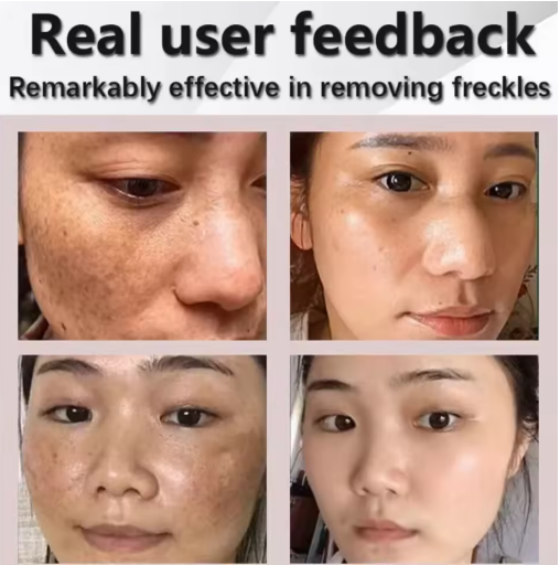 Eelhoe - Pigment Correcting Cream (Original)