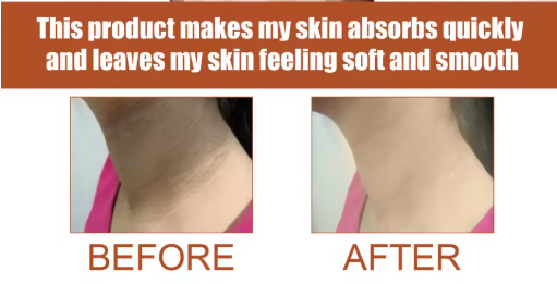 Eelhoe - Pigment Correcting Cream (Original)
