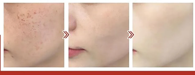 Eelhoe - Pigment Correcting Cream (Original)