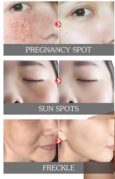 Eelhoe - Pigment Correcting Cream (Original)