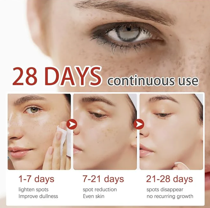 Eelhoe - Pigment Correcting Cream (Original)