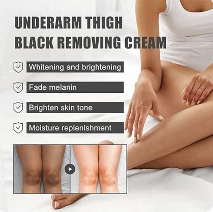 Dark Spot Remover Cream