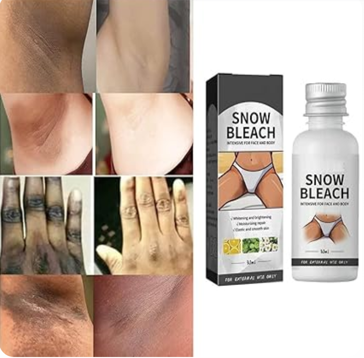 Dark Spot Remover Cream