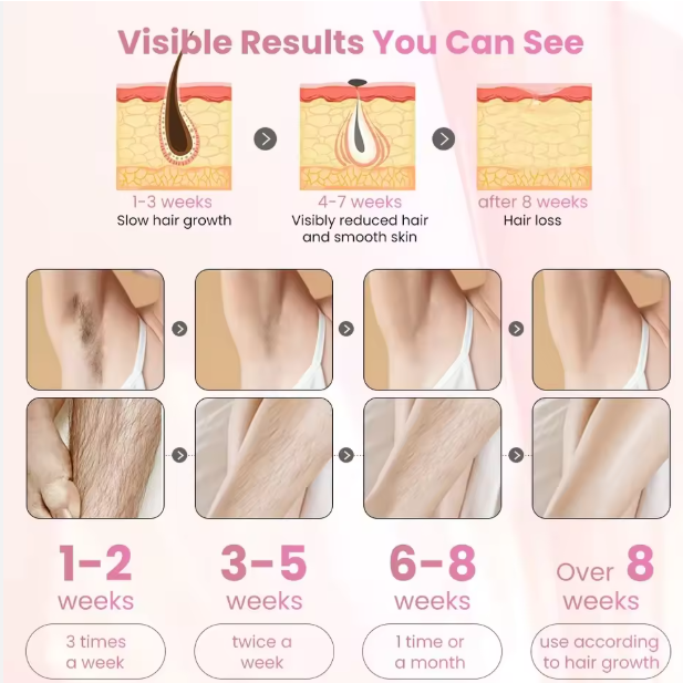 Mini Laser Hair Removal