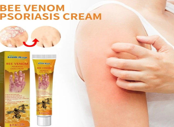 South Moon - Bee Venom Psoriasis Care Cream (Original)