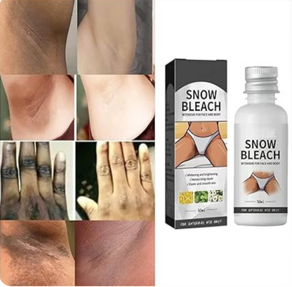 Dark Spot Remover Cream