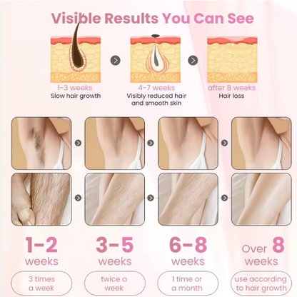Mini Laser Hair Removal